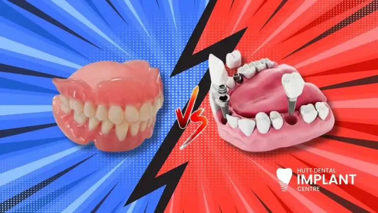 HDIC - Dental Implants vs Dentures
