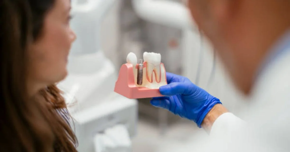 Dental Implants
